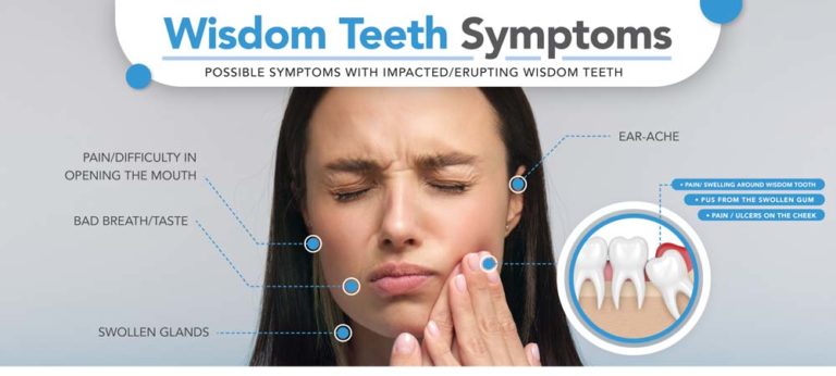 5-wisdom-teeth-symptoms-wheaton-oral-surgery-dpd-smiles