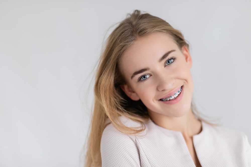 early orthodontic treatment in Wheaton and St. Charles smile girl with braces